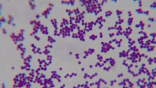 Micromorphology bacterial strain Lactococcus lactis subsp. lactis under the light microscope (magnification of 1000 times). Image of Lidia Stoyanova