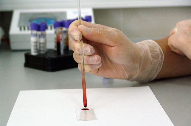 blood analyses cancer
