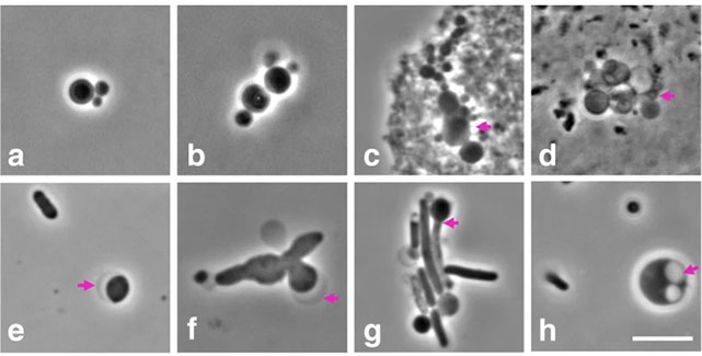 Связки, характерные для деления L-форм (a, b). Пурпурные стрелки на (c) и (d) указывают на предполагаемые L-формы бактерий, ассоциированные со слизистыми эукариотическими клетками; на (e) и (f) они указывают на серповидные выпуклости, напоминающие внешнюю мембрану у L-форм грамотрицательных бактерий; на (g) отмечена возможная промежуточная стадия между оболочной и L-образной формами; на (h) видны внутренние мембранные пузырьки.