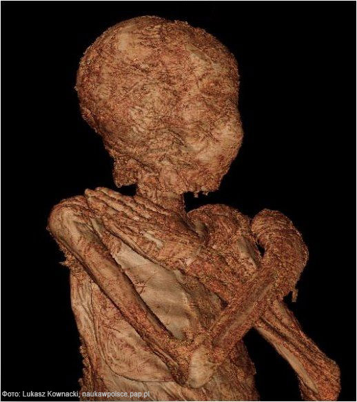Компьютерная томография мумии