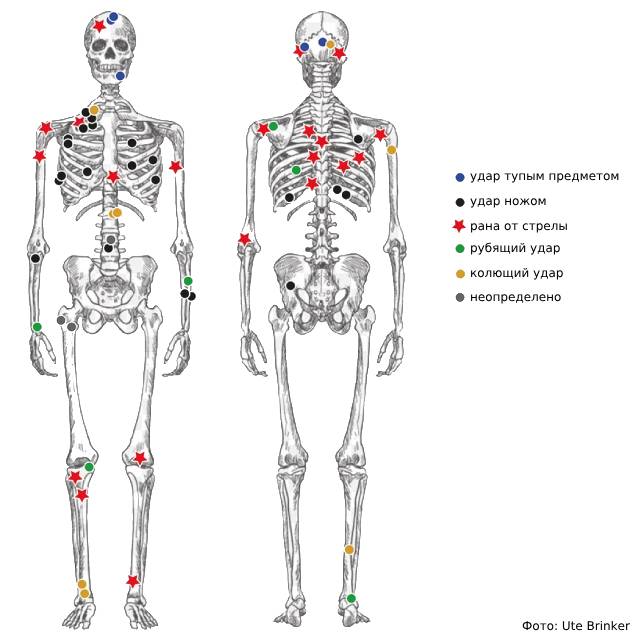 Травмы, которые исследователи обнаружили на телах павших
